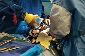 맹장염 증상과 원인