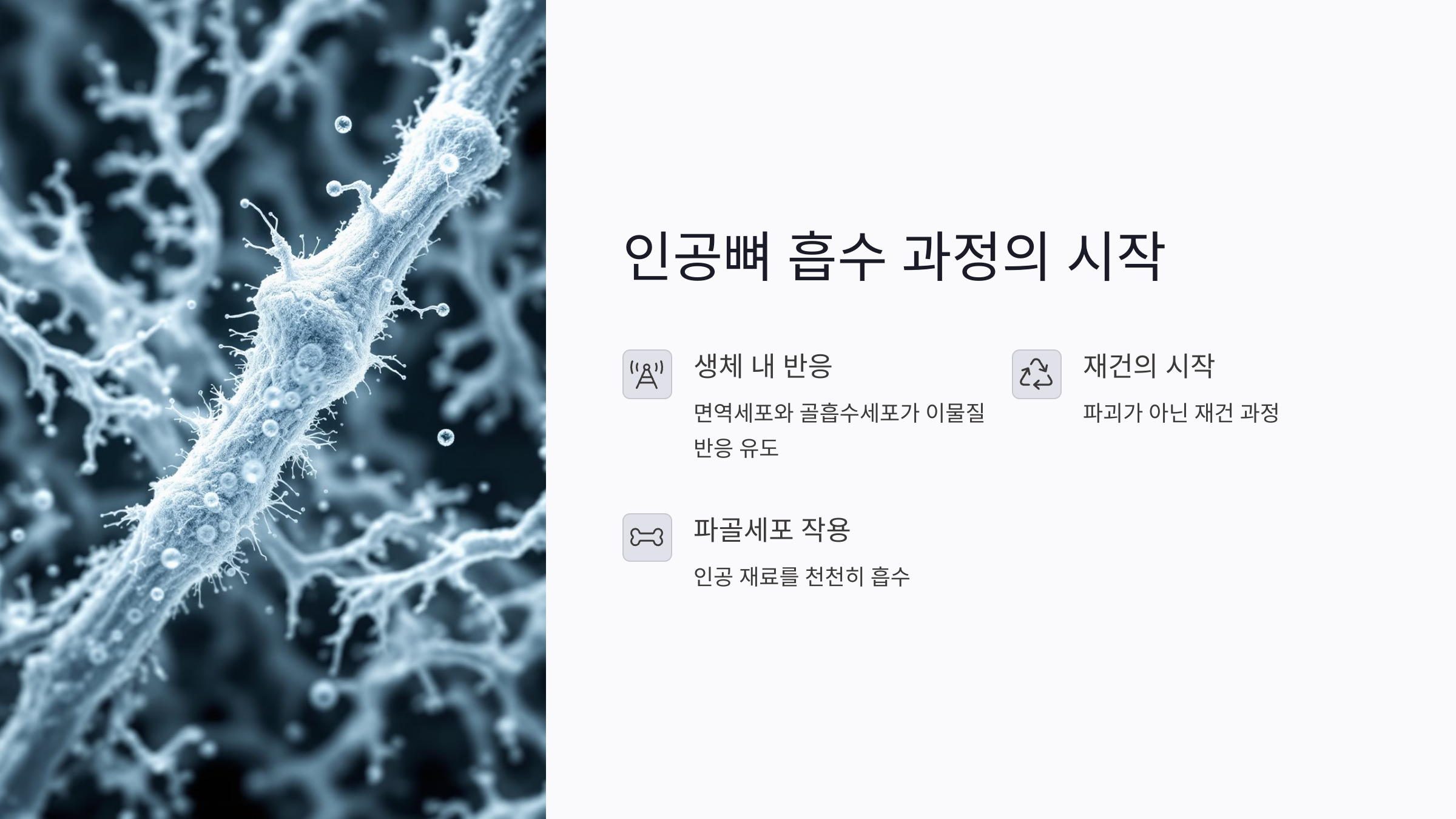 치과 인공뼈 흡수 과정의 시작