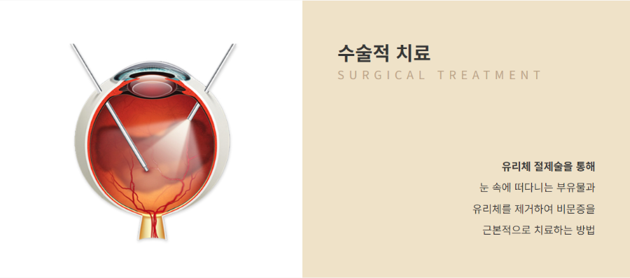 수술적 치료
