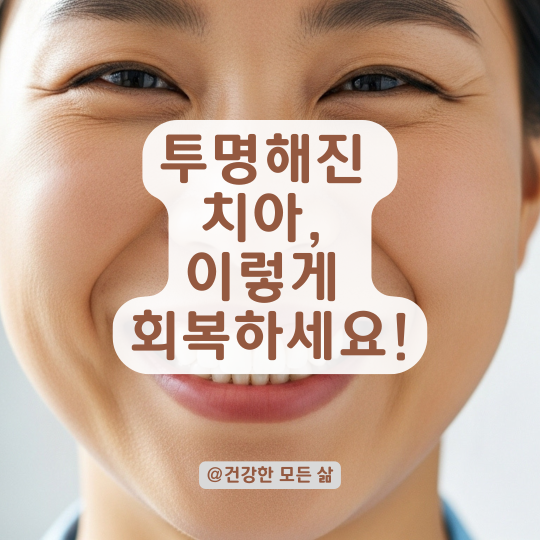 치아가 투명해지고 시리다면? 마모 의심 증상과 회복 방법.