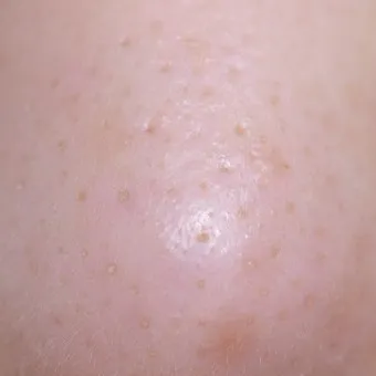 남자 얼굴 피지 제거 화장품 꿀템_12