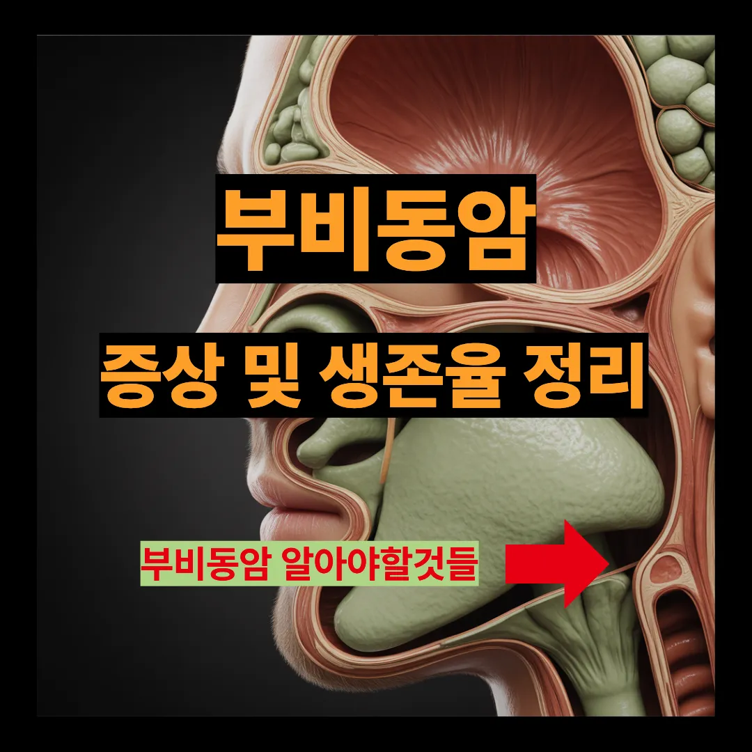 부비동암 증상 및 생존율 정리