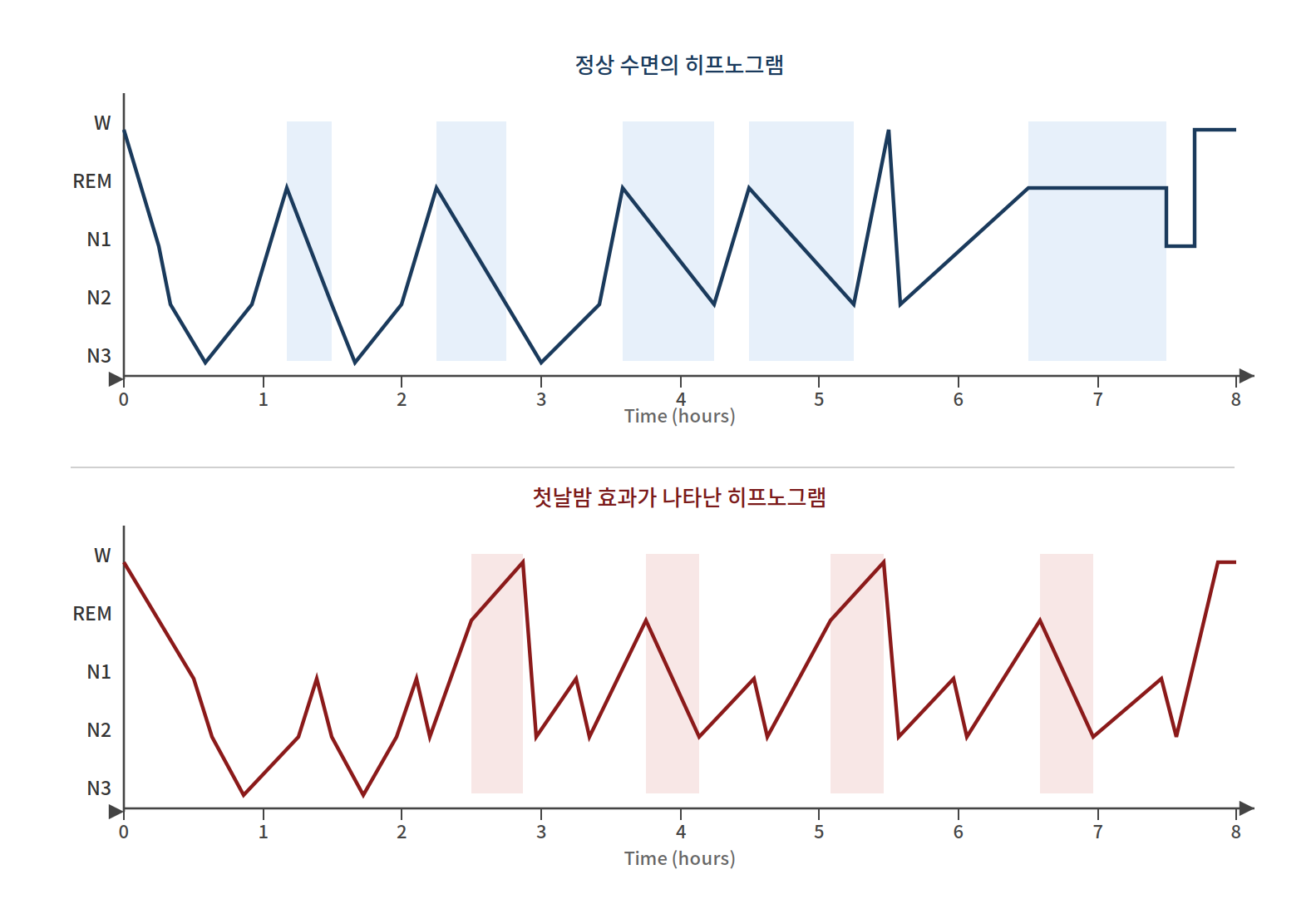 정상 수면 히프노그램과 첫날밤 효과(first-night effect)가 나타난 수면 구조 비교 도식