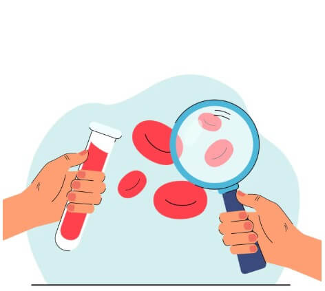 혈관 속 노폐물의 정도