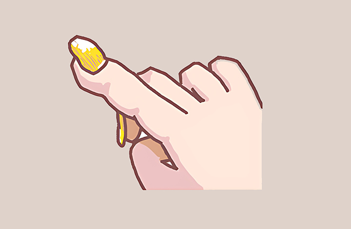 두껍고-변색된-손톱-모습