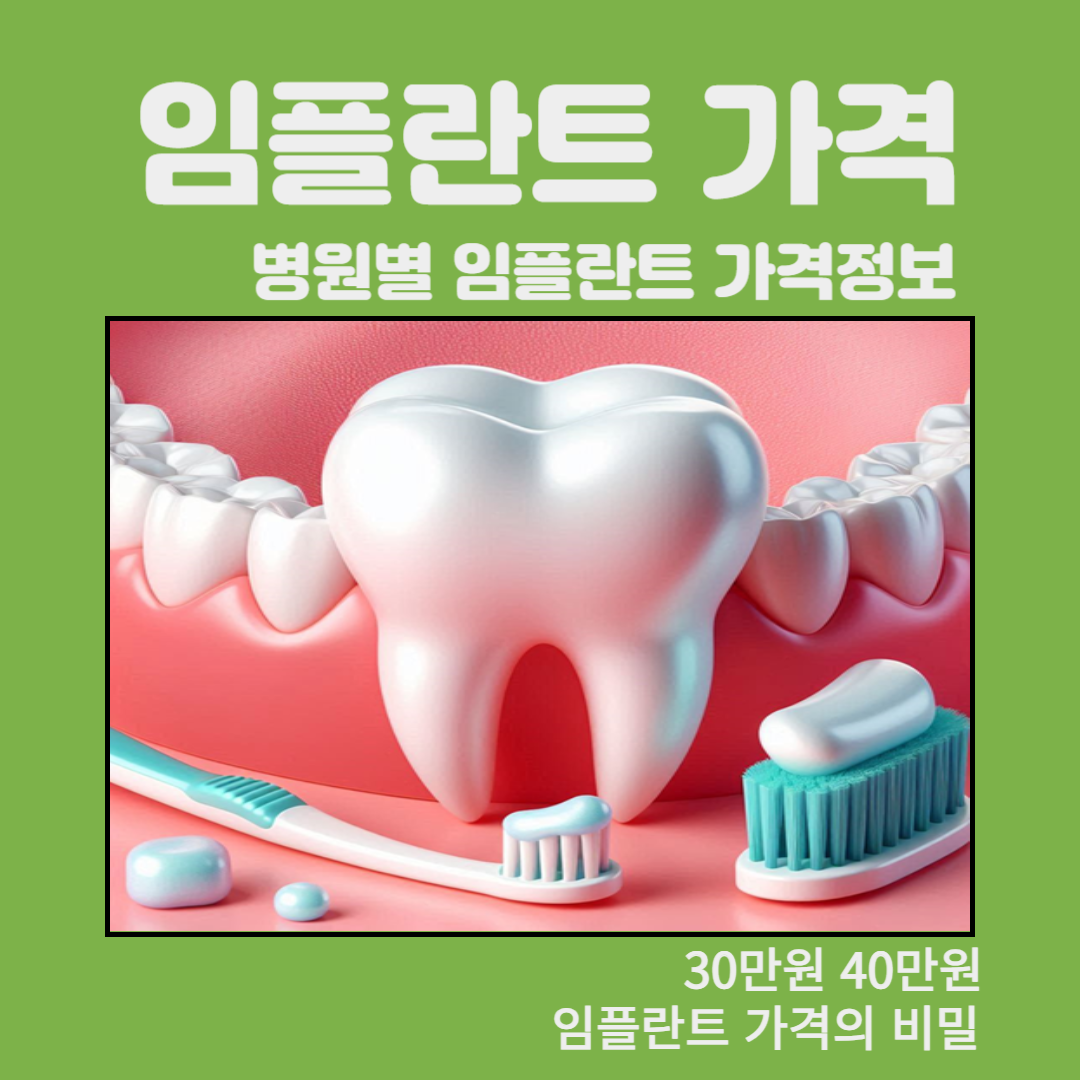 임플란트 가격 병원별 가격 정보