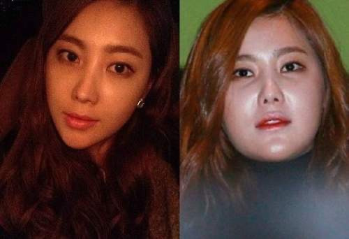 솔비 성형 다이어트