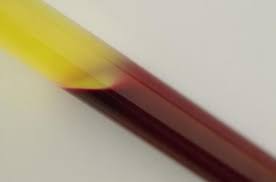 백혈구 정상수치 