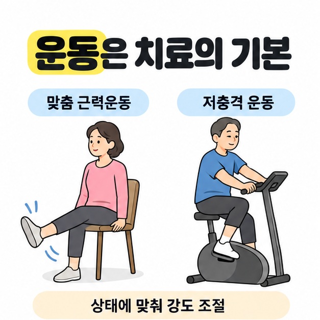 의자에 앉아 한쪽 다리를 펴는 맞춤 근력운동과 실내 자전거를 타는 저충격 운동을 나란히 보여주고 상태에 맞춘 강도 조절을 안내한 그림
