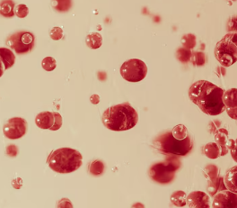 피부 붉은반점 23