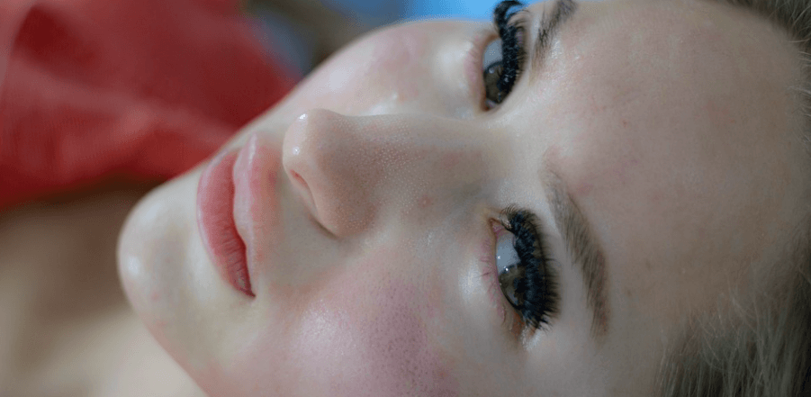 여드름이 나 있는 모습 - 5