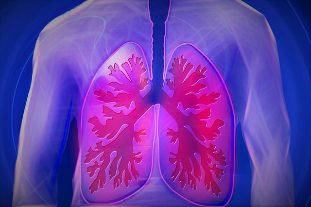 만성폐쇄성폐질환(COPD) 설명을 위한 폐 그림