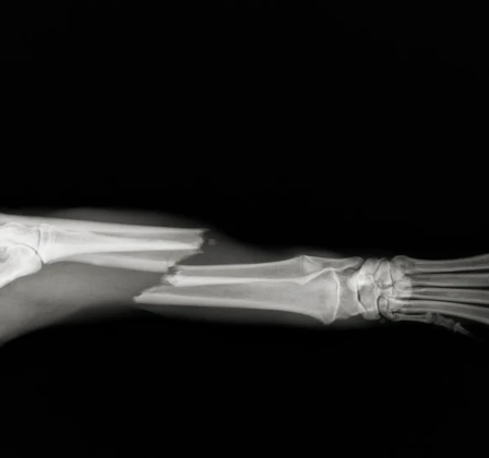 강아지 골절 종류&amp;#44; 증상&amp;#44; 수술 후 관리법 총정리