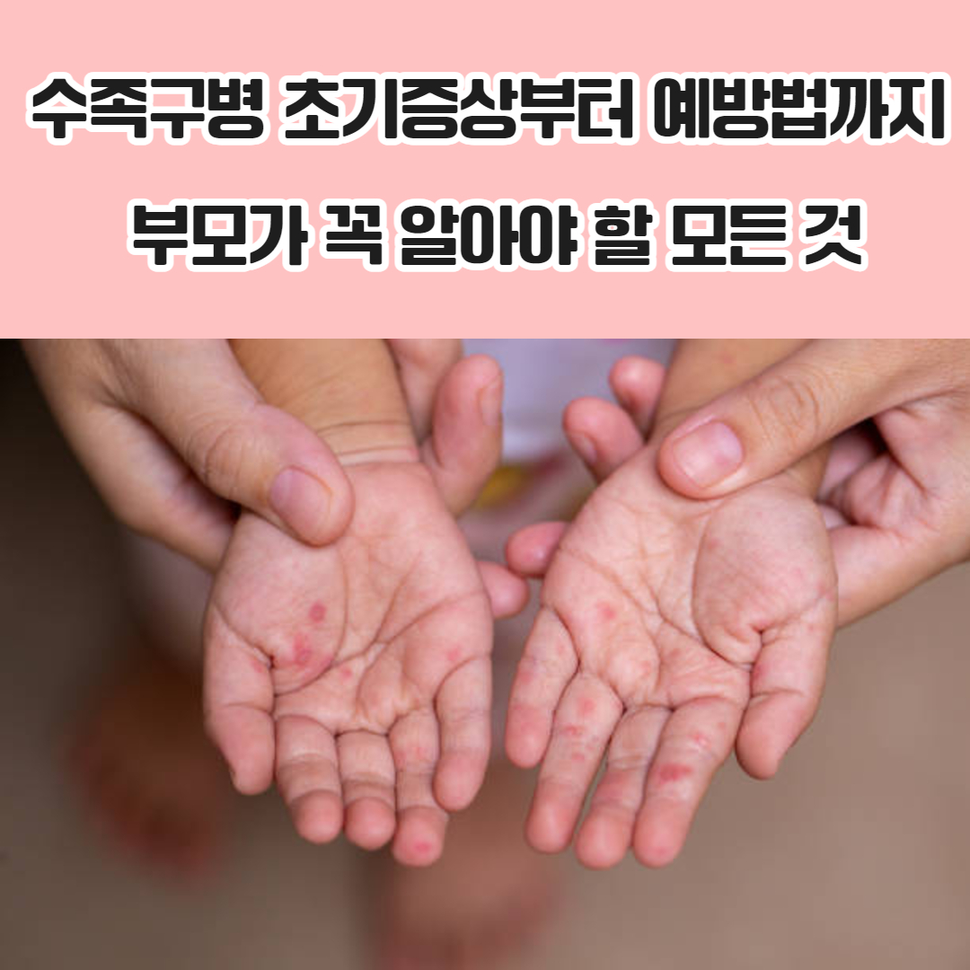 수족구병 초기증상부터 예방법까지, 부모가 꼭 알아야 할 모든 것