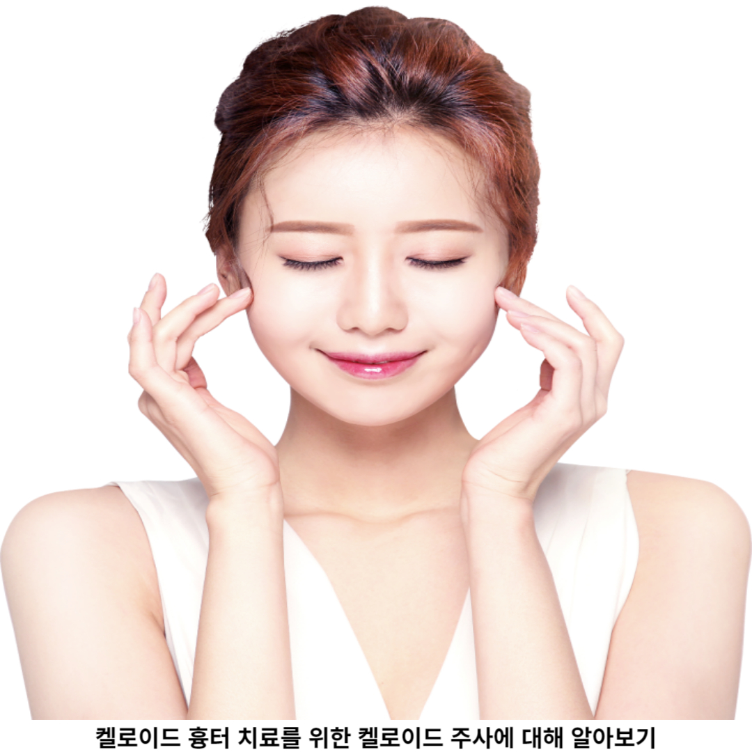 켈로이드 주사 치료 / 예방