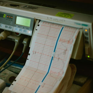 치매 검사 비용 - 정밀 인지검사