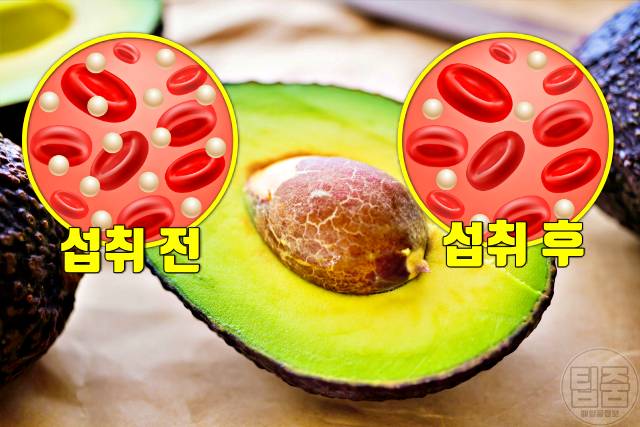 아보카도 매일 먹으면 아보카도 효능 혈당 아보카도 1인분