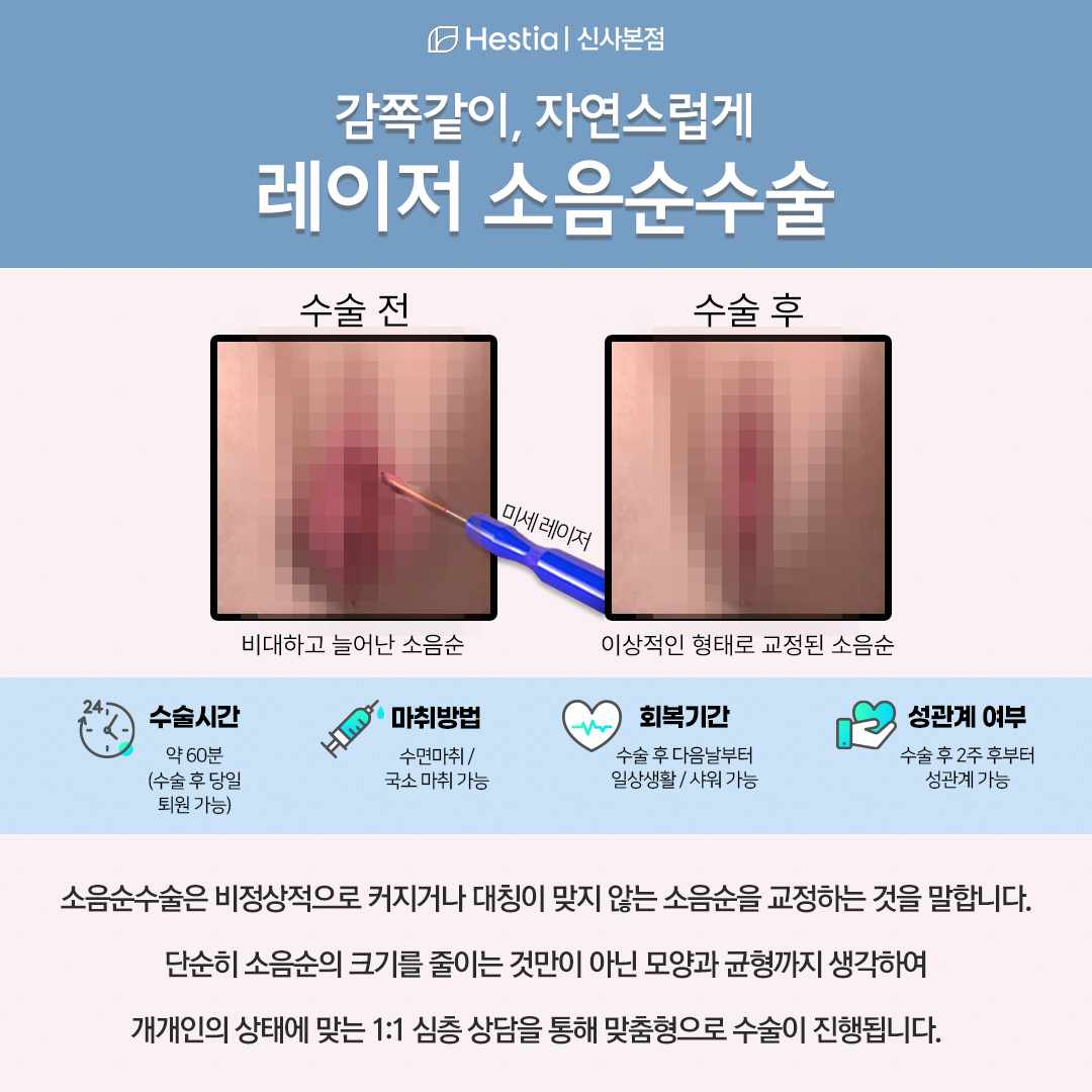 서울산부인과 헤스티아 레이저 소음순수술