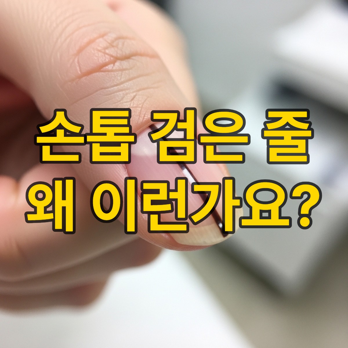 손톱 검은 세로줄