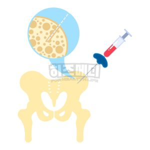 백혈구 수치가 낮은 이유