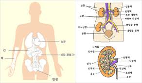 신장암