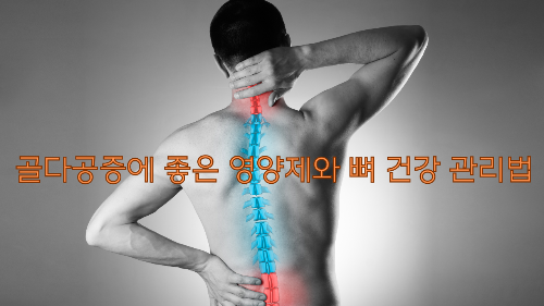 골다공증에 좋은 영양제와 뼈 건강 관리법