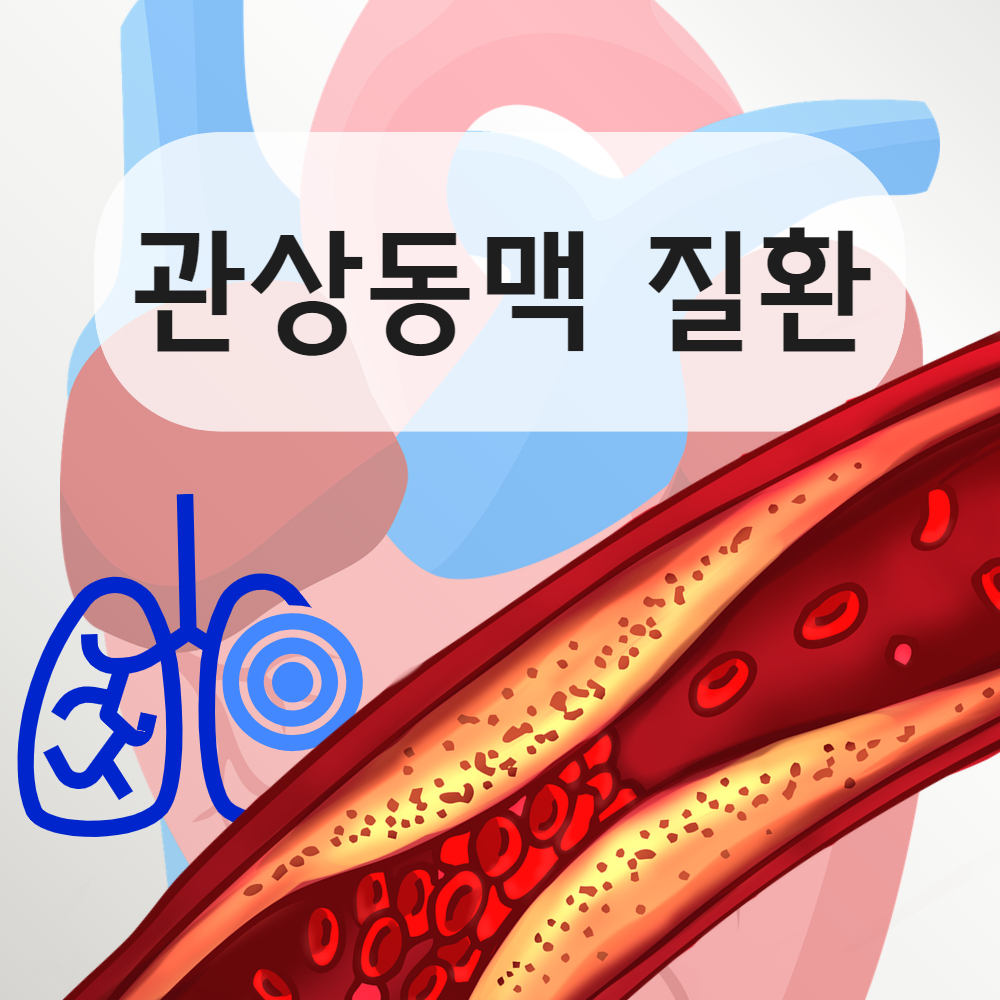 관상동맥 질환