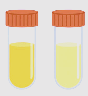 소변 색깔로 보는 건강