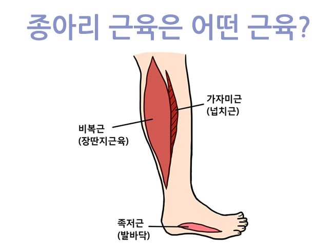 종아리 근육파열 증상