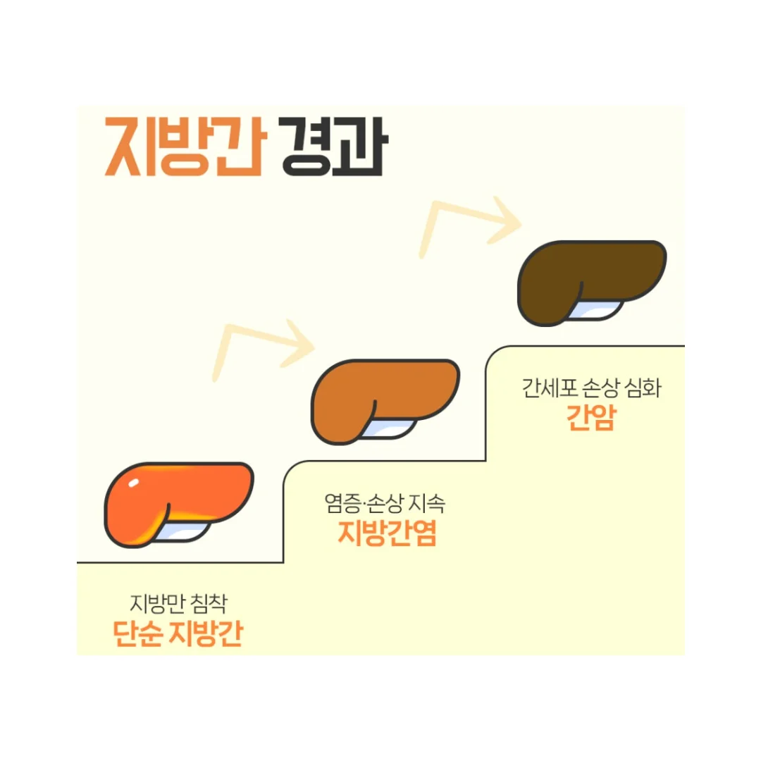 남편 지방간 나아지는 4주 비법