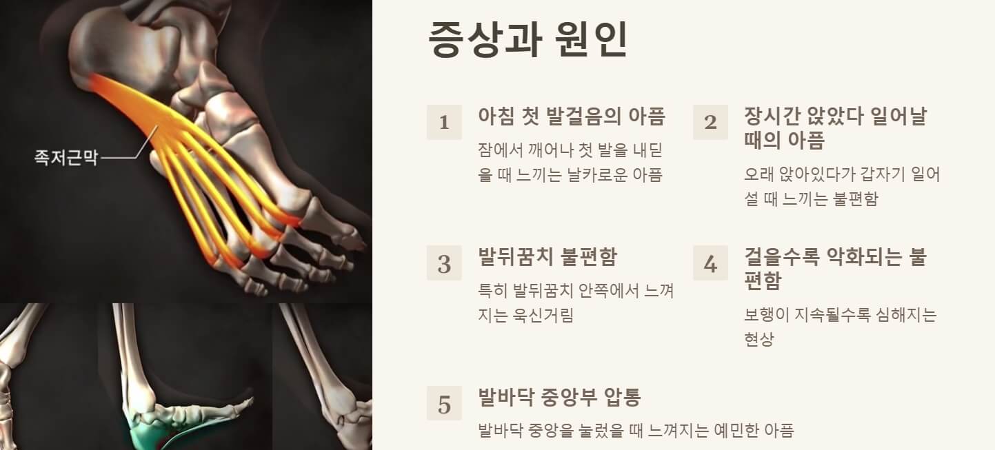 족저근막염 증상 치료법