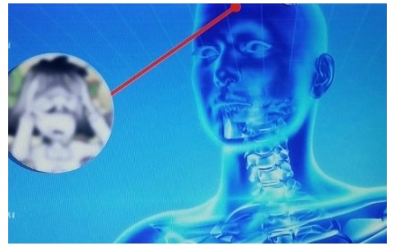 수험생 안면통증