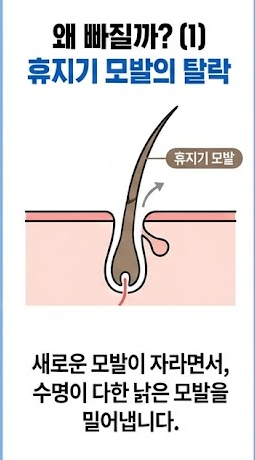 미녹시딜 부작용