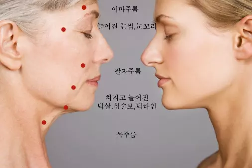 턱살과 볼살
