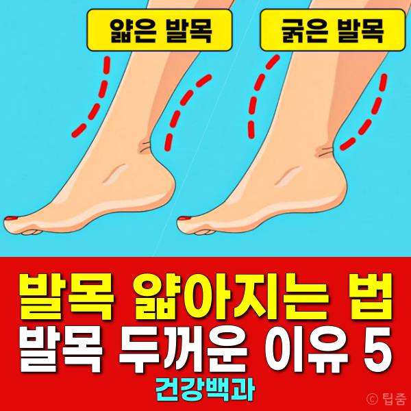 발목 얇아지는 법 발목 두꺼운 이유