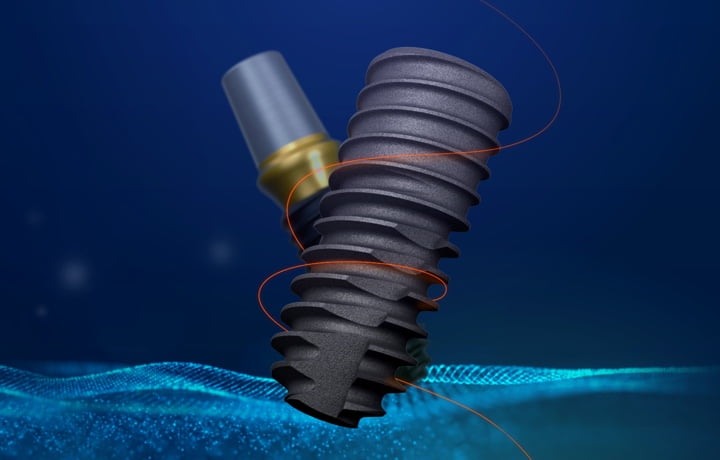 임플란트 종류와 회사 선택&amp;#44; 기간&amp;#44; 수술&amp;#44; 뼈이식