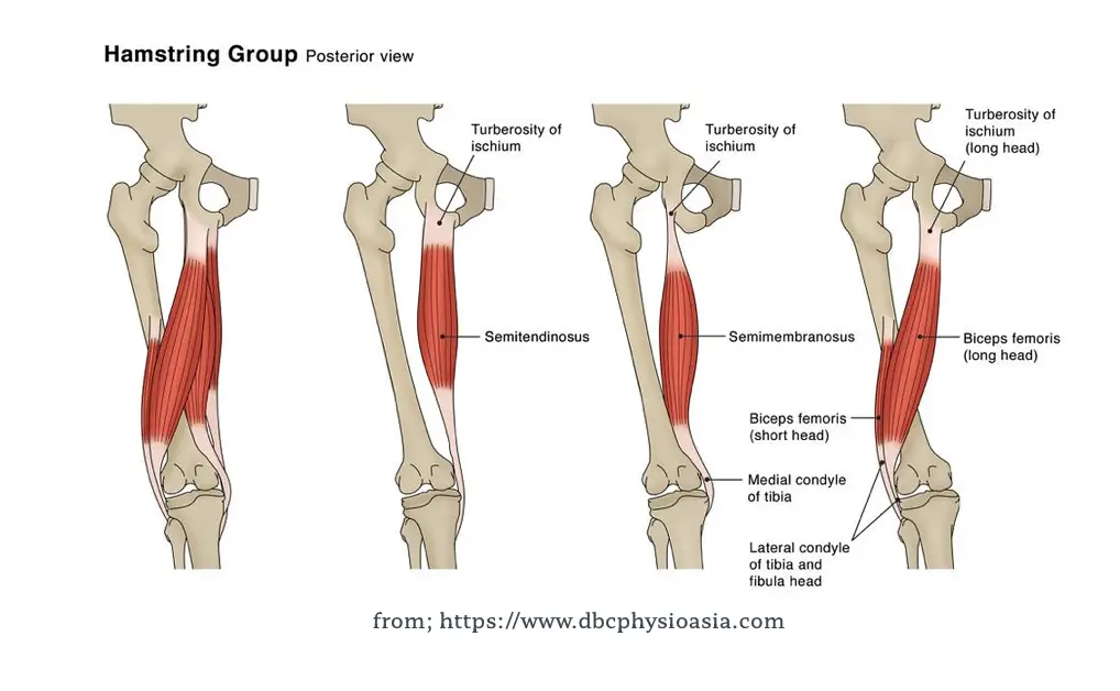 슬개대퇴통증증후군: 원인, 증상 및 효과적인 관리 방법