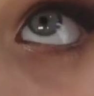 눈밑혈관있는-여자