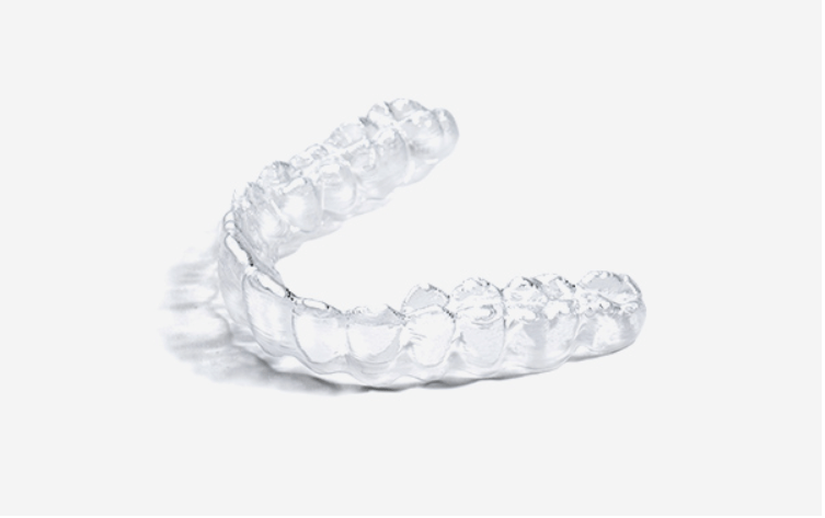 투명교정장치(인비절라인 등): 탈부착 가능, 최신 기술의 집약