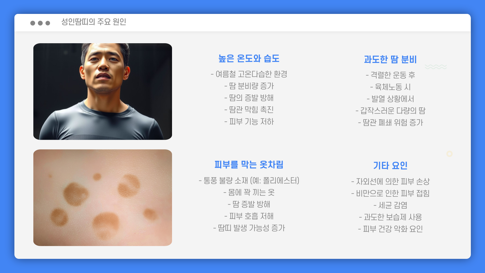 성인땀띠-원인