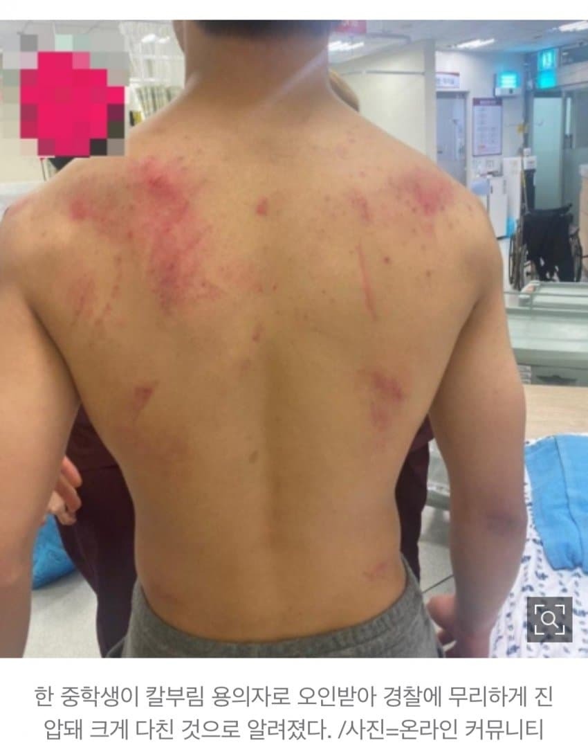 경찰의 무리한 진압 논란