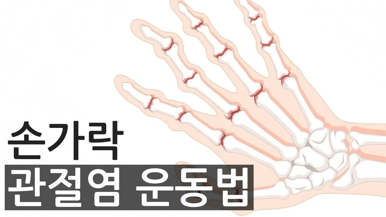 손가락 관절염 증상