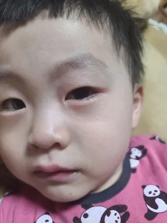 고양이 털 알레르기 완화 방법과 생활 관리 팁_18