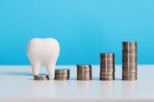 임플란트 가격 4