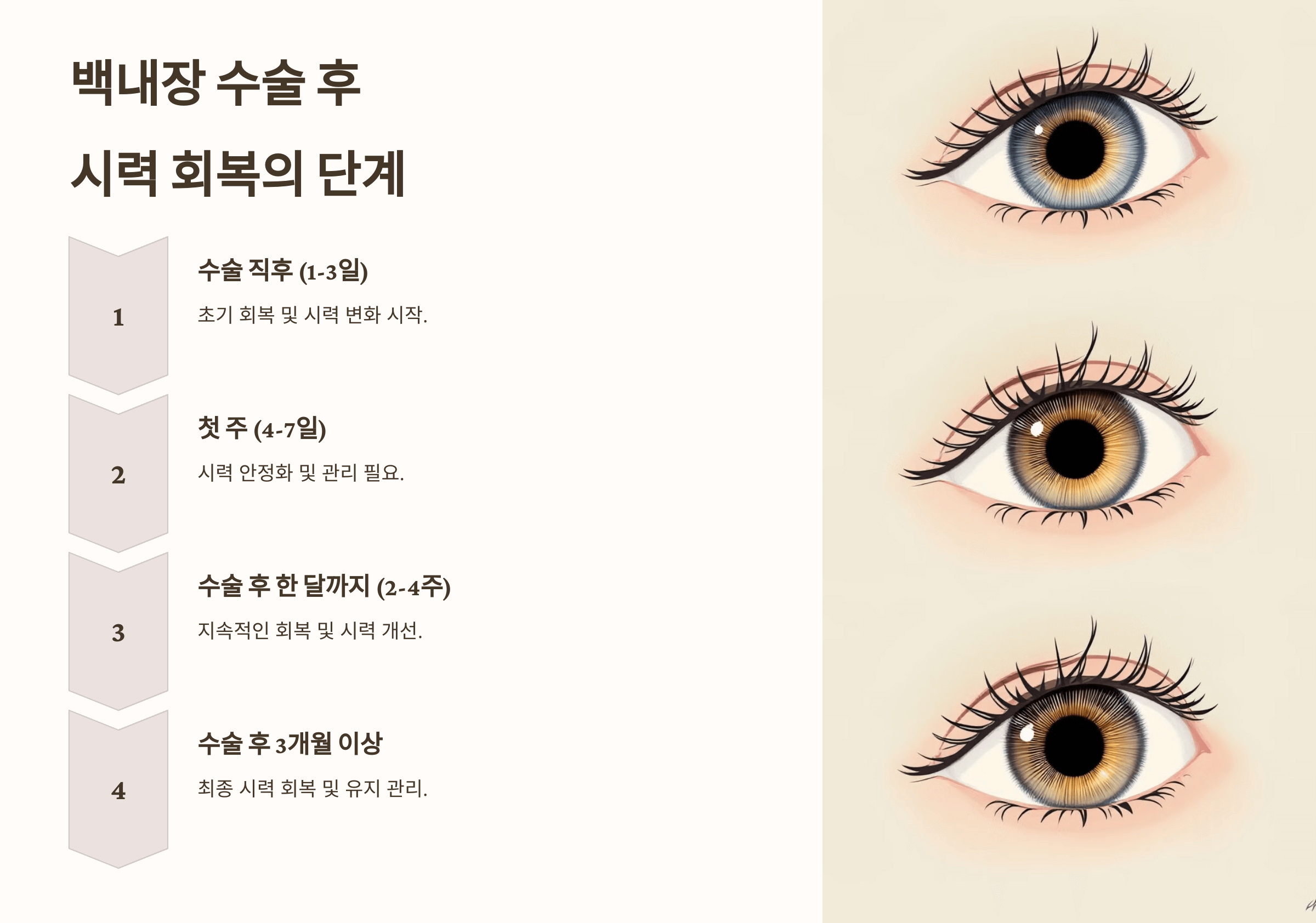 백내장과 관련된 사진입니다.