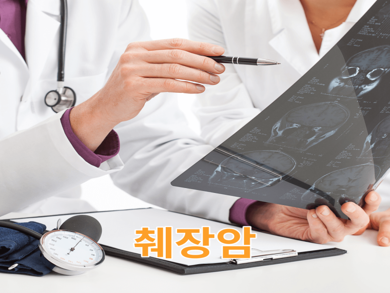 췌장암은 조기 발견이 어려운 암이다.