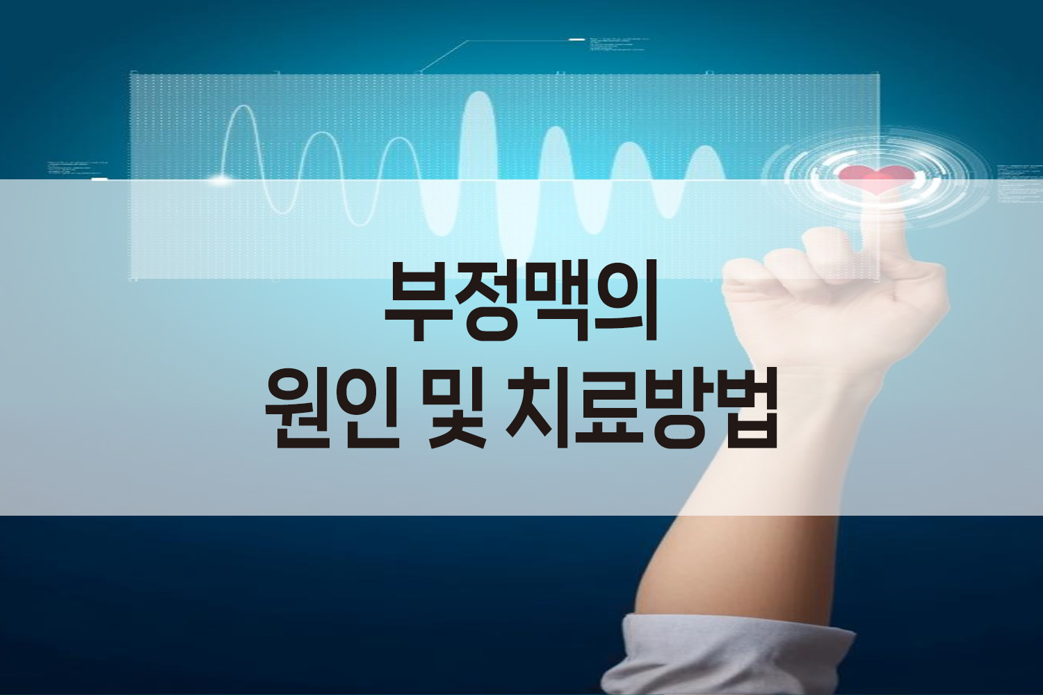 부정맥의 원인 및 치료방법