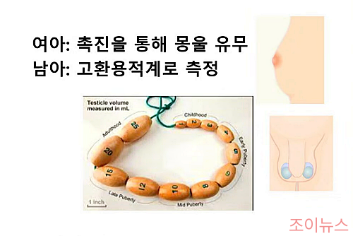 진성 vs 가성 성조숙증 진단검사