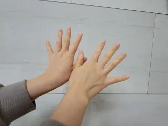 손등 붓는 이유 혈액순환 문제 증상과 해결법 정리_10
