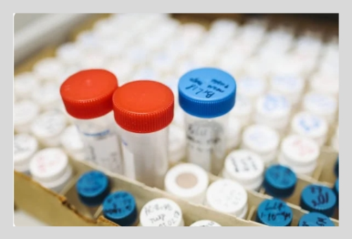 빈뇨 치료와 관리 방법